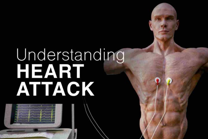 《了解心脏病》Understanding Heart Attack