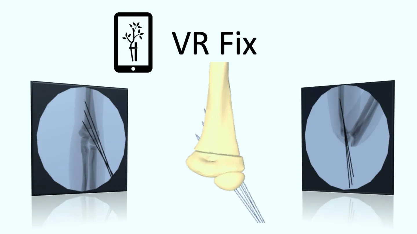 《X射线模拟》VR Fix Supra